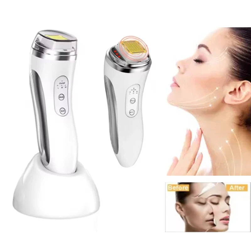 Dispositivo de Radiofrecuencia Facial para Reafirmar y Rejuvenecer la Piel