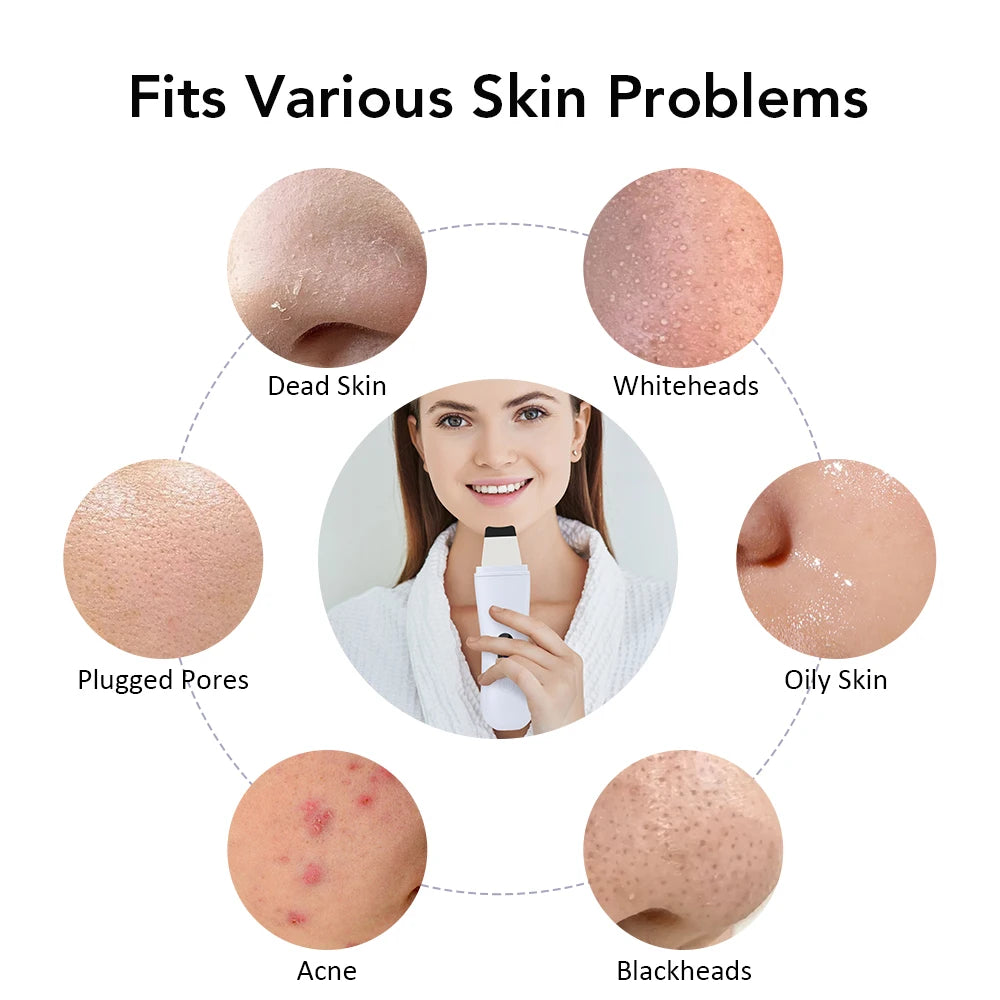 Espátula Ultrasónica Facial Profesional – Limpieza Profunda y Lifting con Tecnología Iónica