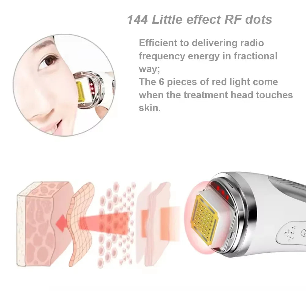 Dispositivo de Radiofrecuencia Facial para Reafirmar y Rejuvenecer la Piel